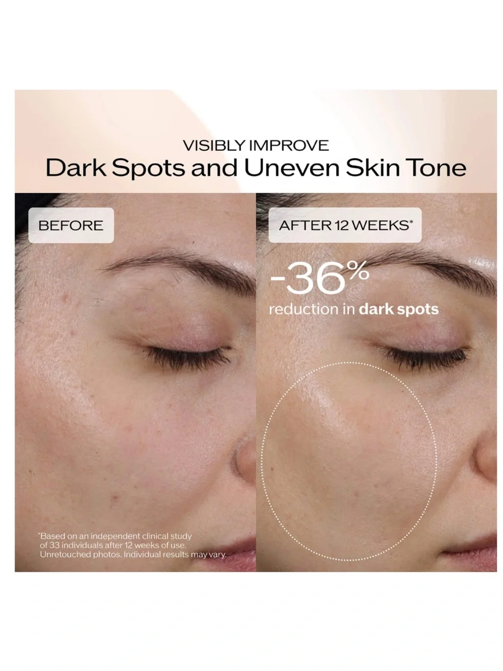 Shiseido Benefiance Dark Spot & Wrinkle Smoothing Serum NIB